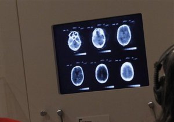 Ученый: Клетки мозга могут жить в два раза дольше, чем сам организм