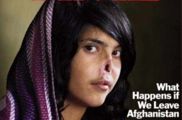 Новый нос Аиши Мохаммадзаи, похудение с помощью авокадо и как избежать ПМС  – итоги недели