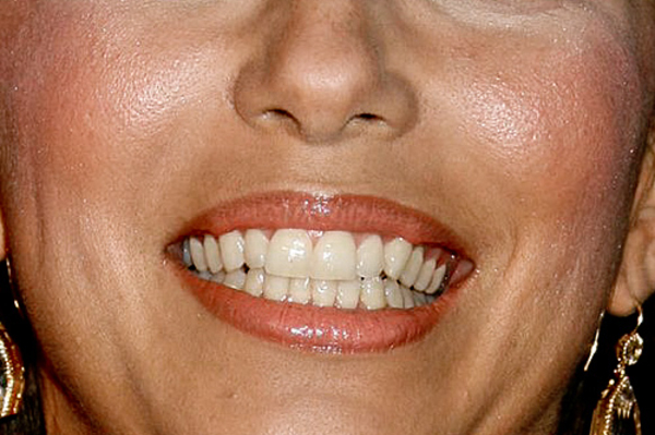 celebritycloseup.tumblr.com