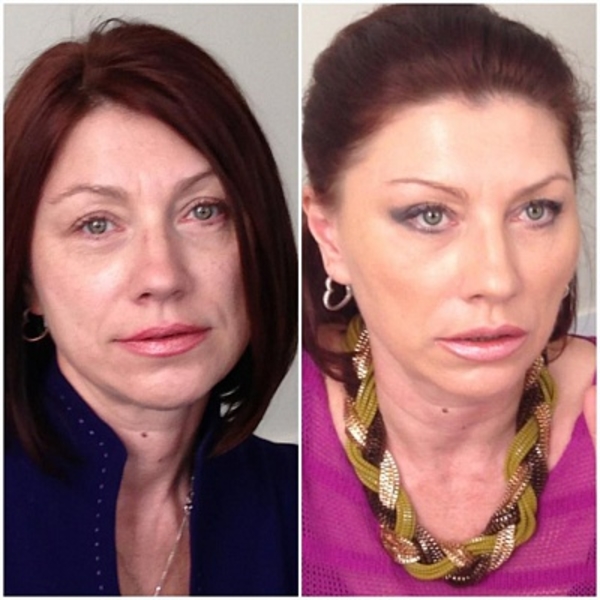 Как пластический хирург "исправил" лицо Розы Сябитовой