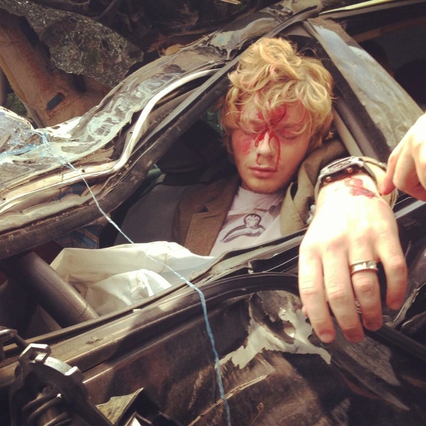 Кривошапко напугал поклонников окровавленным лицом