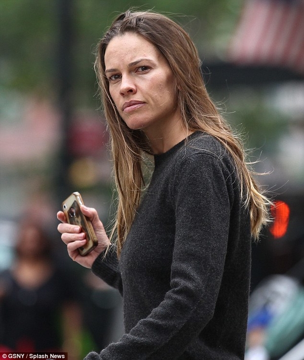 39-летняя Хилари Суонк страдает от подростковых акне