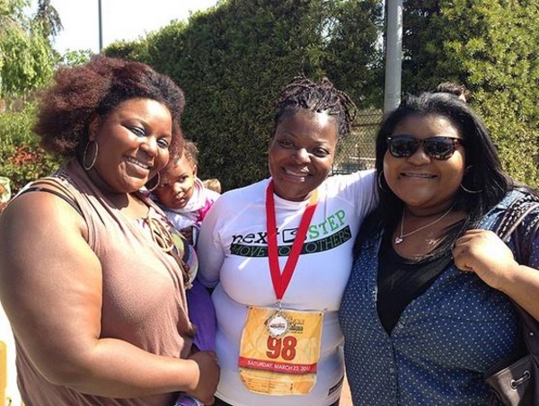 Женщине ампутировали конечности из-за процедуры по увеличению ягодиц