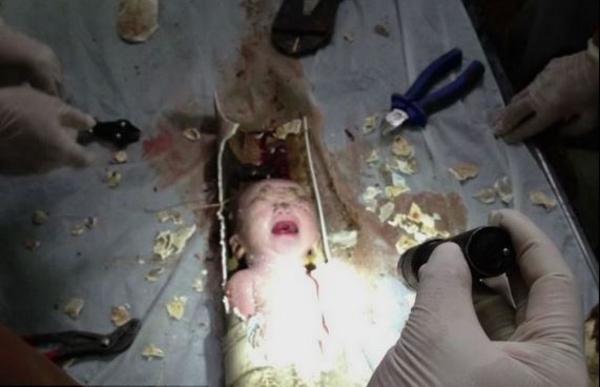 Чудо-спасение младенца, неизвестная болезнь в Бенине и коронавирус в Украине – итоги недели