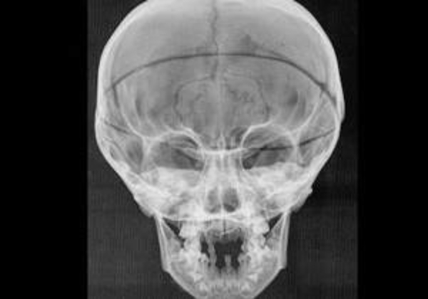 Суровый дворцовый режим: Специалисты назвали диагноз потомков Медичи