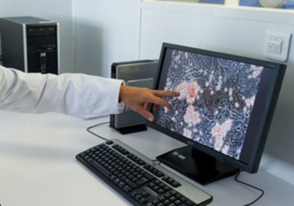 Для проведения анализа крови предлагают использовать лазер