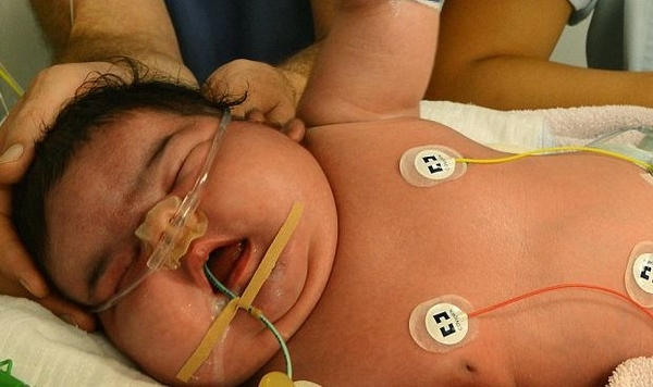 Женщина родила девочку весом более 6 кг