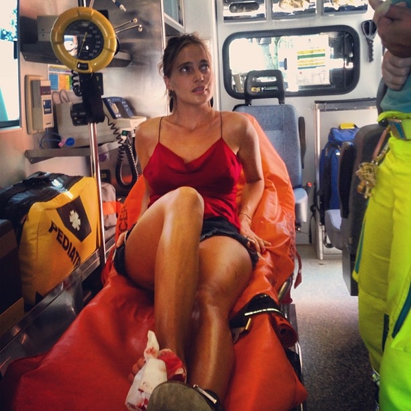 Певица Глюкоза получила травму на отдыхе в Италии