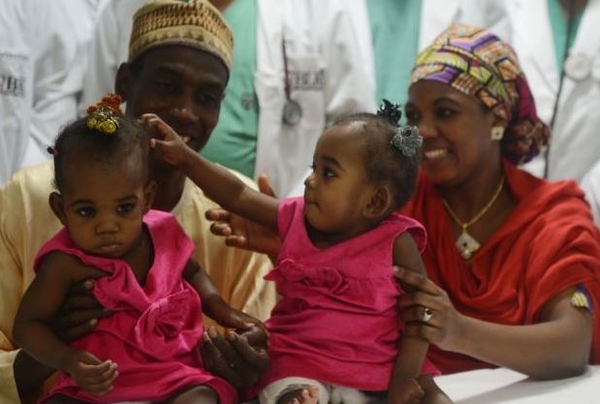 Годовалых сиамских близнецов успешно разделили