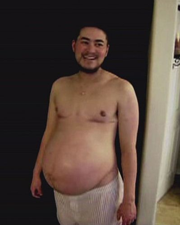 Немец выносил и родил здорового ребенка