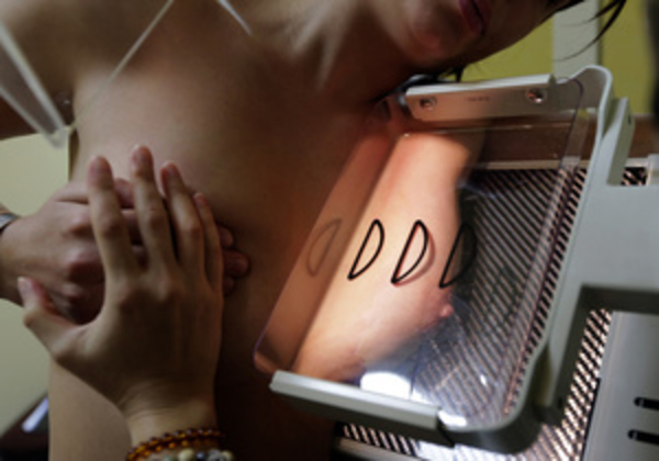 Ученые: После операции грудь можно восстановить с помощью стволовых клеток