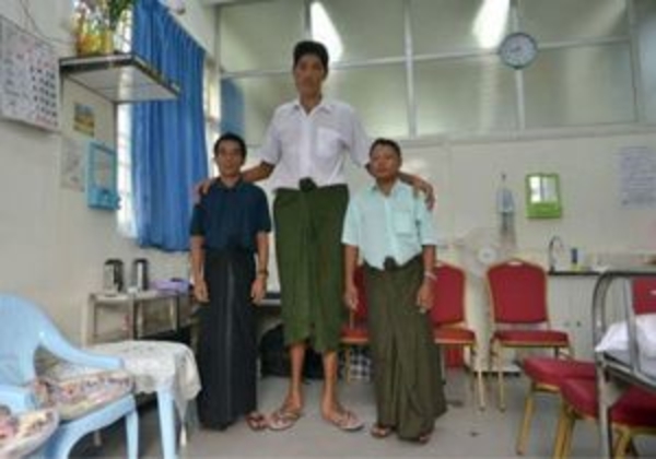 Самому высокому человеку в Мьянме спасли жизнь