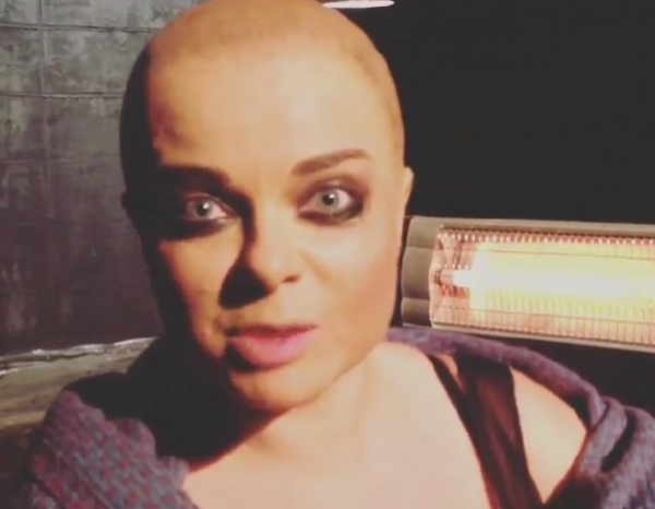 Наташа Королева побрилась налысо и показала фото