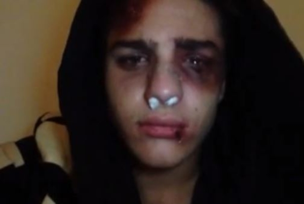 Рома Желудь обратился к фанатам: Я жив, и я справлюсь