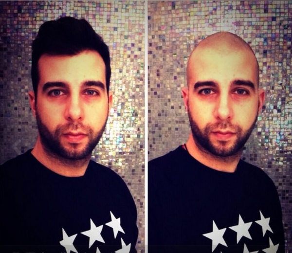 Иван Ургант побрился налысо: Оставь прическу в старом году