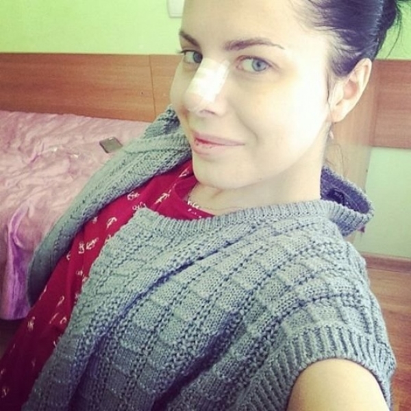 Алена Лоран показала фото после пластики носа