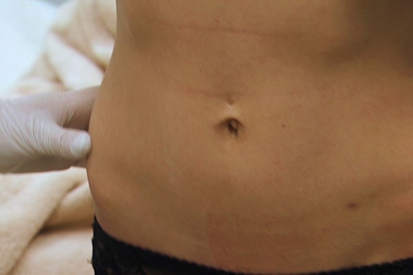 пресс-служба СТБ