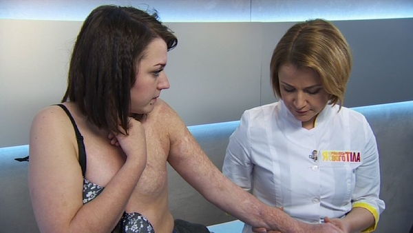 Я соромлюсь свого тіла: Девушка без груди и опухоль губы в 4-ом эфире