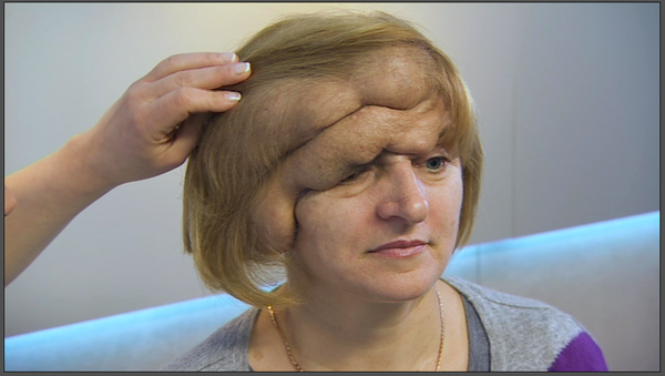 Я соромлюсь свого тіла: Большая опухоль, интимные проблемы и другое