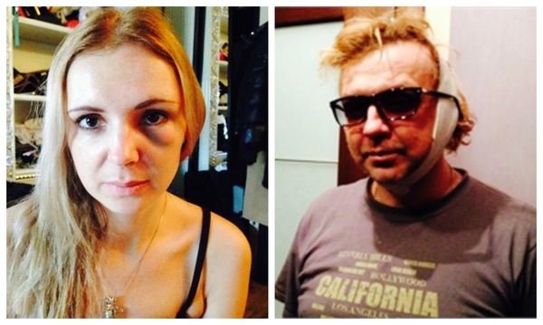 Певца Рому Жукова и его жену избили