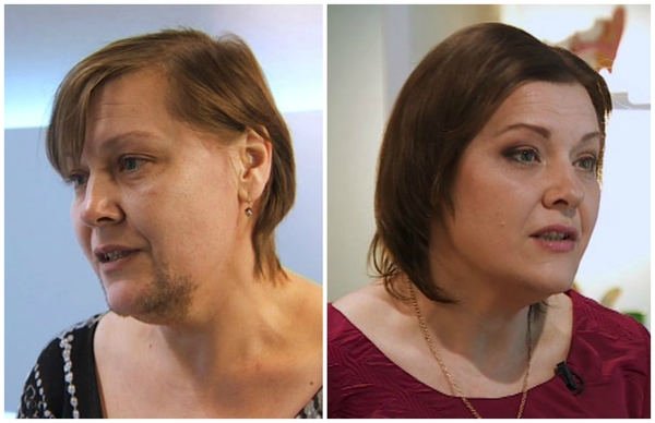 Я соромлюсь свого тіла: Фото героя 6-го эфира до и после