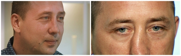 Я соромлюсь свого тіла: Фото героя 7-го эфира до и после