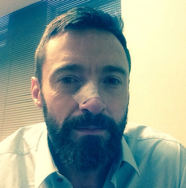 Хью Джекман борется с раком: Обнаружили новую опухоль