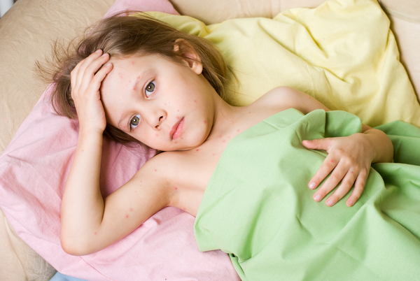 Как бороться с крапивницей?