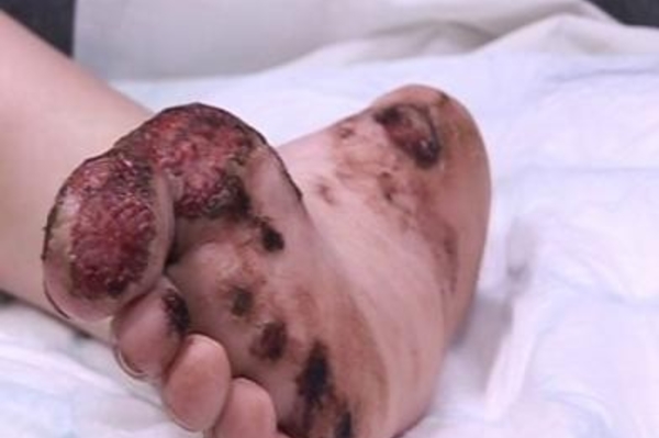 channel4embarrassingillnesses.com