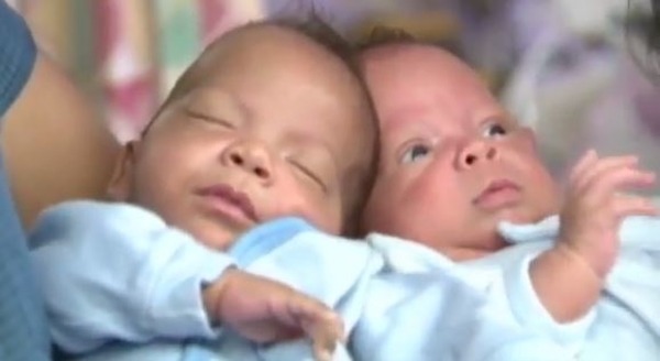 Близнецы родились с разницей почти в месяц