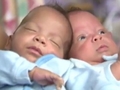 Близнецы родились с разницей почти в месяц