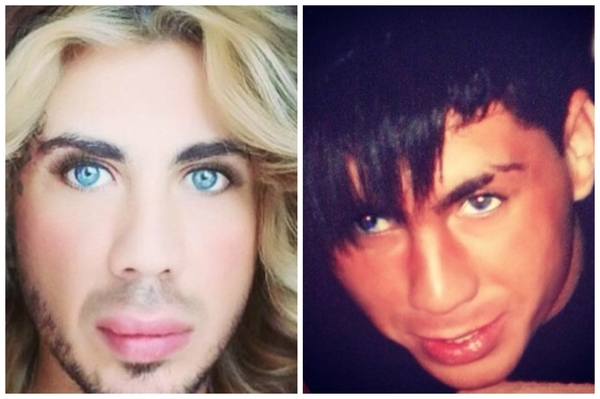 В Сеть попало фото Сергея Пастуха до пластики