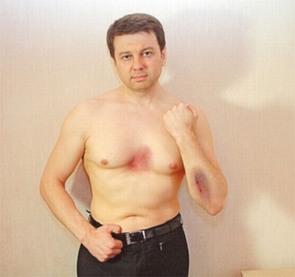 Тимофей Нагорный о разводе с Лилией Подкопаевой: У каждого своя правда