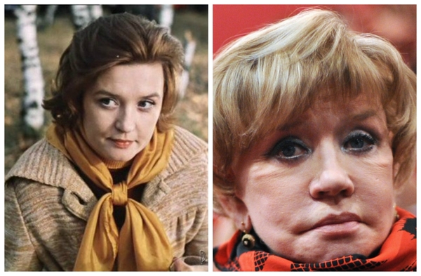 Всемирный День красоты: ТОП-10 звезд, одержимых пластикой