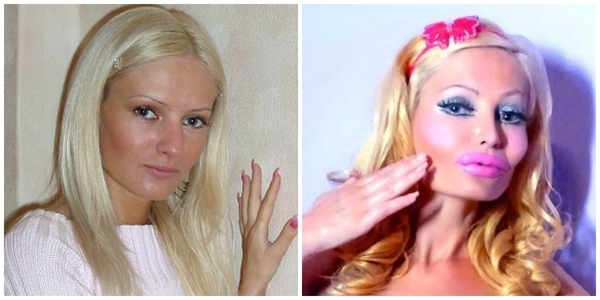 Модель решилась на пластику, чтоб стать похожей на секс-куклу