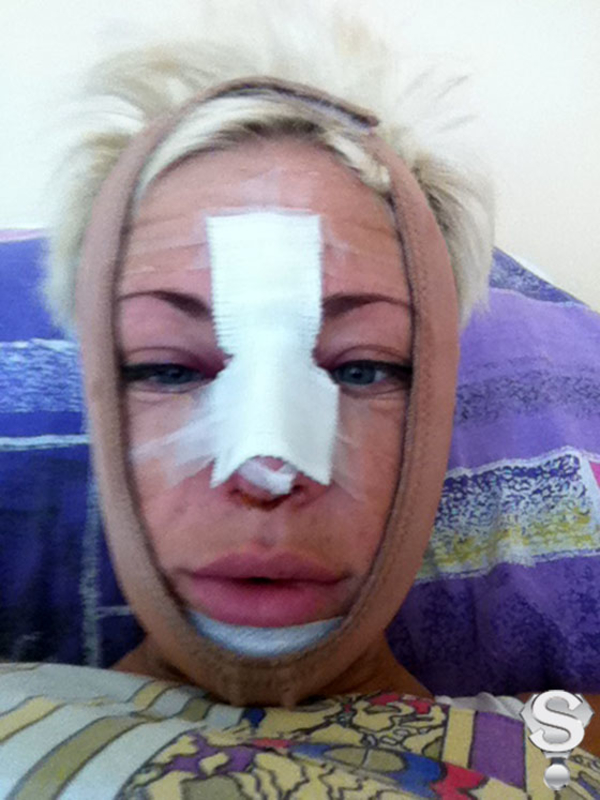 Певица Саша Project стала жертвой пластического хирурга