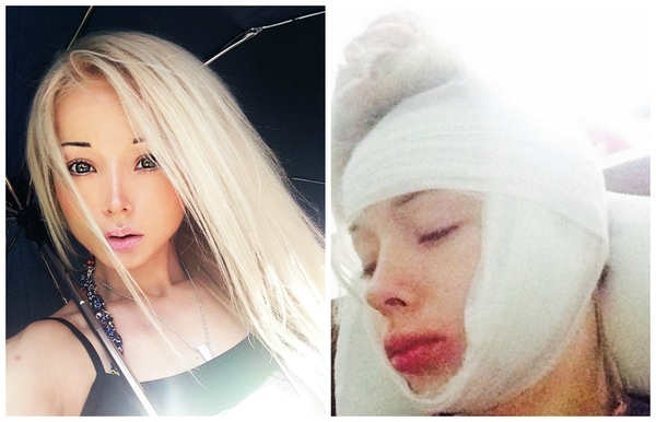 Одесскую Барби избили на улице: У людей нет ни капли сострадания