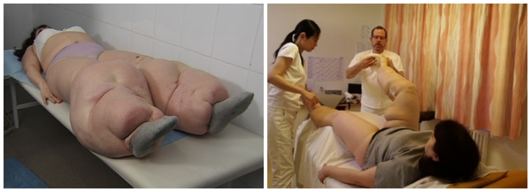 Я соромлюсь свого тіла 2 сезон: Первые результаты лечения (фото до и после)