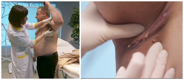 Я соромлюсь свого тіла 2 сезон: Как сложилась судьба Игоря Полынько