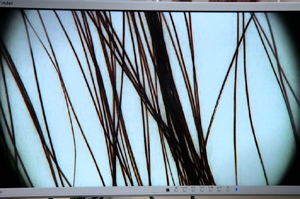 пресс-служба канала СТБ