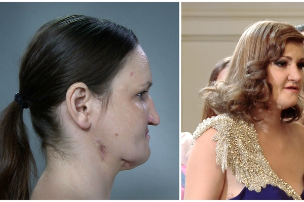 пресс-служба канала 1+1, beauty-back.q-wel.com