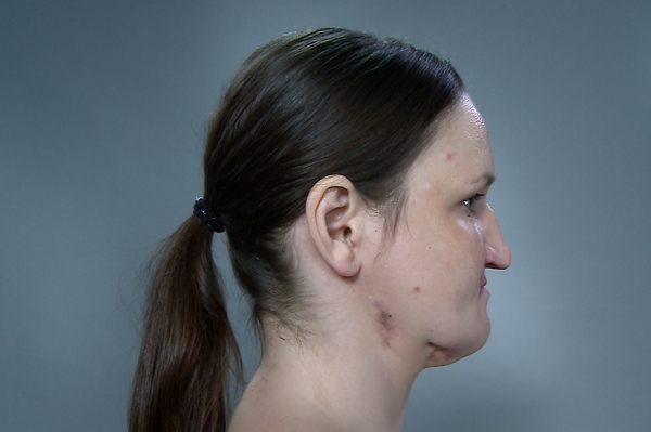 пресс-служба канала 1+1