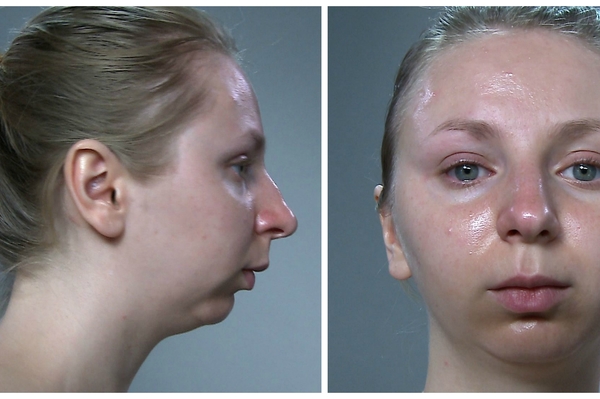 пресс-служба 1+1