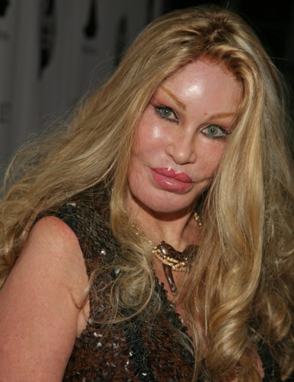 Силикон, ботокс и филлеры: Впечатления пластического хирурга от UFW