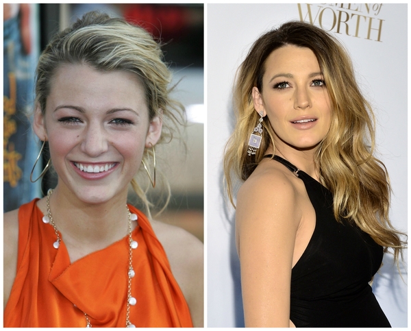 До и после: Знаменитости, которые сделали пластику