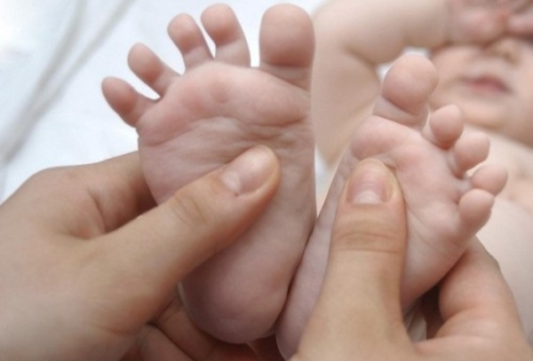 Я соромлюсь свого тіла: Как диагностировать и лечить косолапость