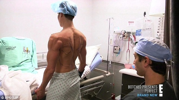 Живой Кен: Мужчина сделал уникальную операцию по пересадке "крыльев"