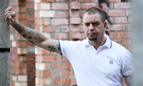 Лидер BRUTTO сравнил политику Путина с "воспалившимся аппендицитом"