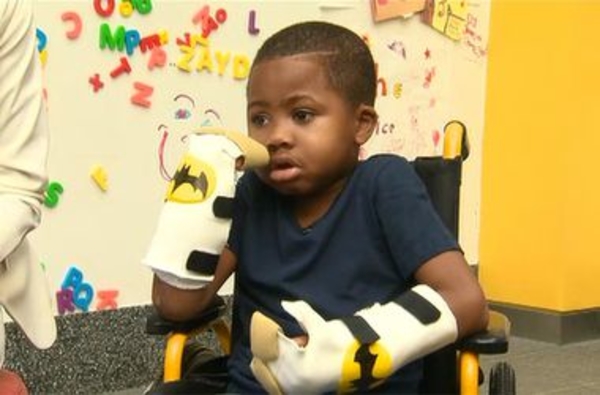 40 врачей сумели пересадить кисти рук 8-летнему мальчику