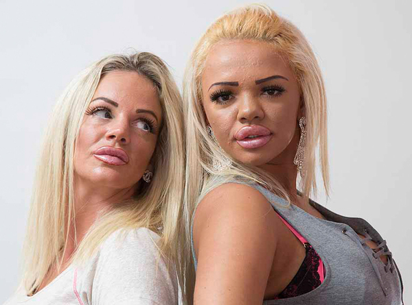 Мать и дочь потратили на пластические операции больше $80 тыс.